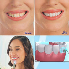 Load image into Gallery viewer, Electric  Whitening Dental Cleaning