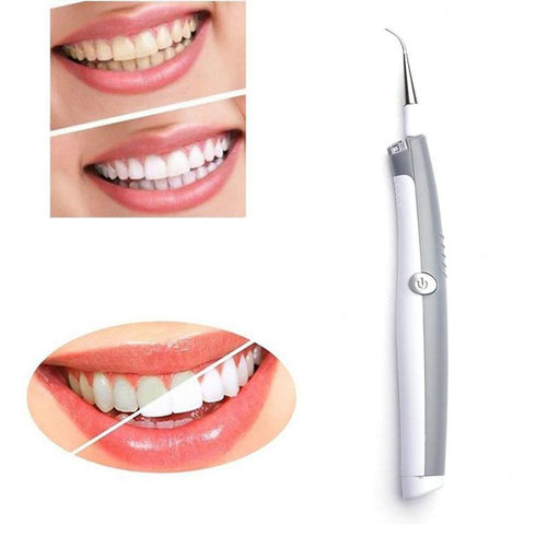 Electric  Whitening Dental Cleaning