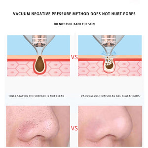Vacuum Cleaner Black Dot Face
